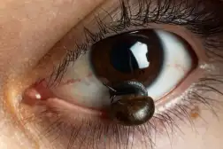 Méta escargot, 2023